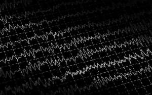 qEEG