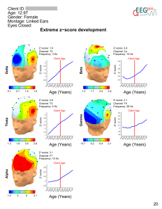 qEEG-Pro-Loreta